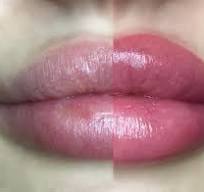 permanente lippen