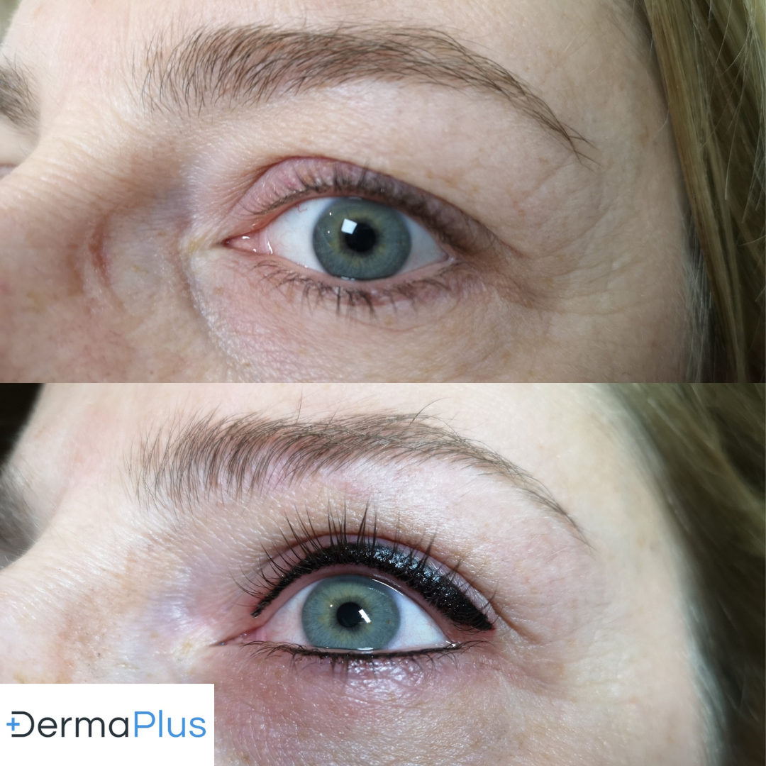 derma instituut wenkbrauwen