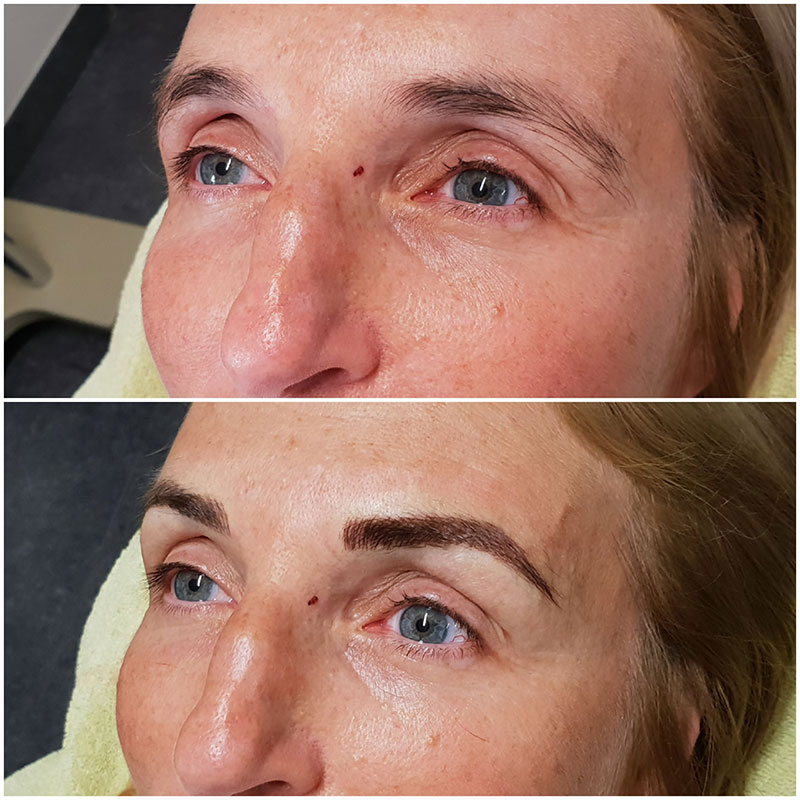 beste microblading