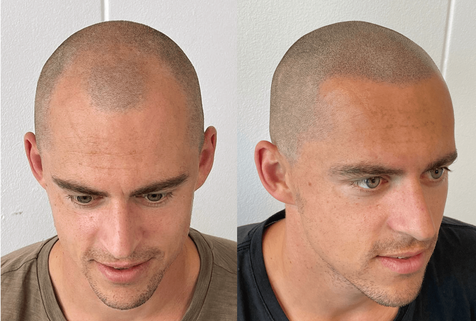haar pigmentatie